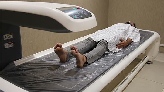 DEXA SCAN