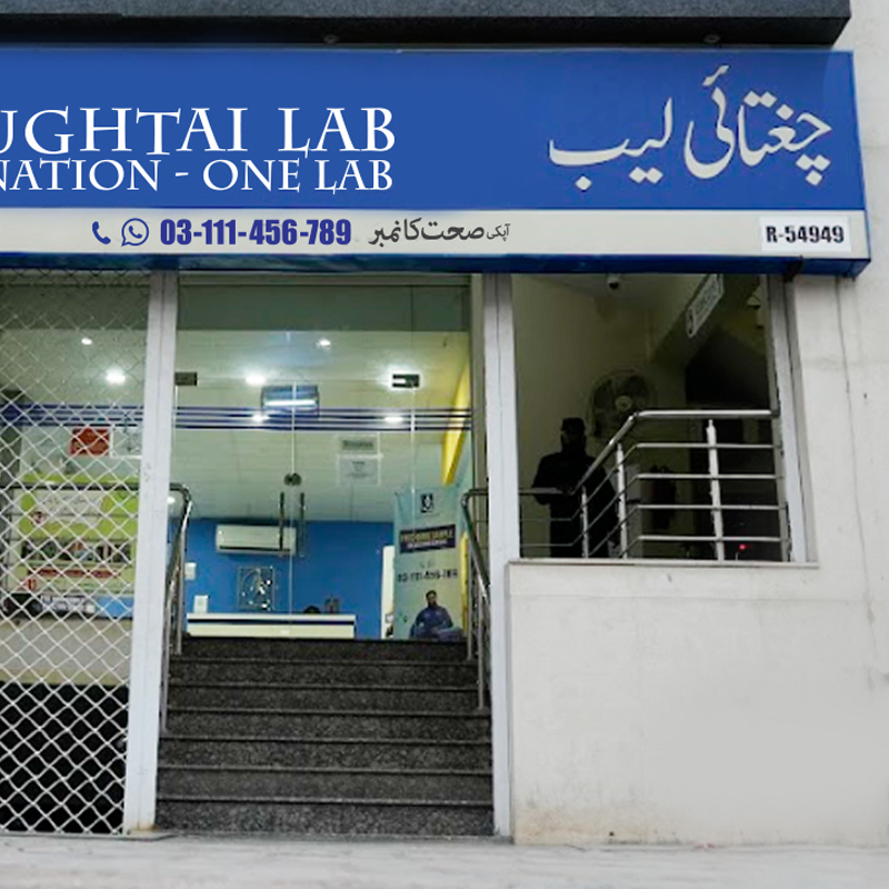 Chughtai Lab Rawalpindi